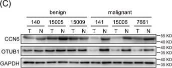 WISP3 Antibody - Azide and BSA Free