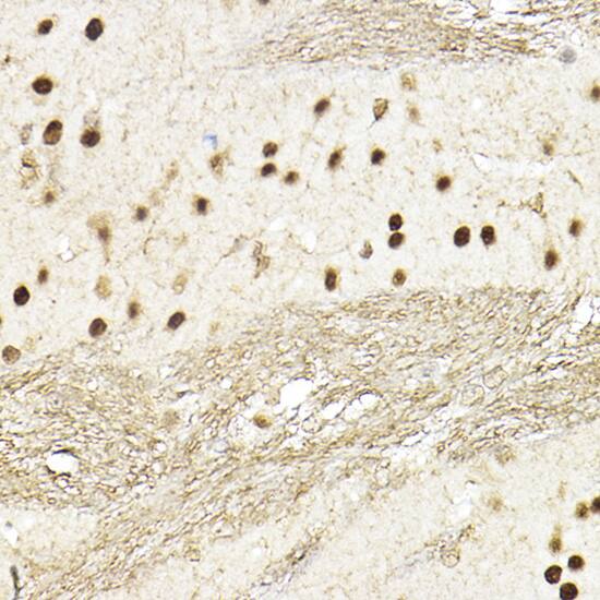 TEAD1 Antibody - Azide and BSA Free