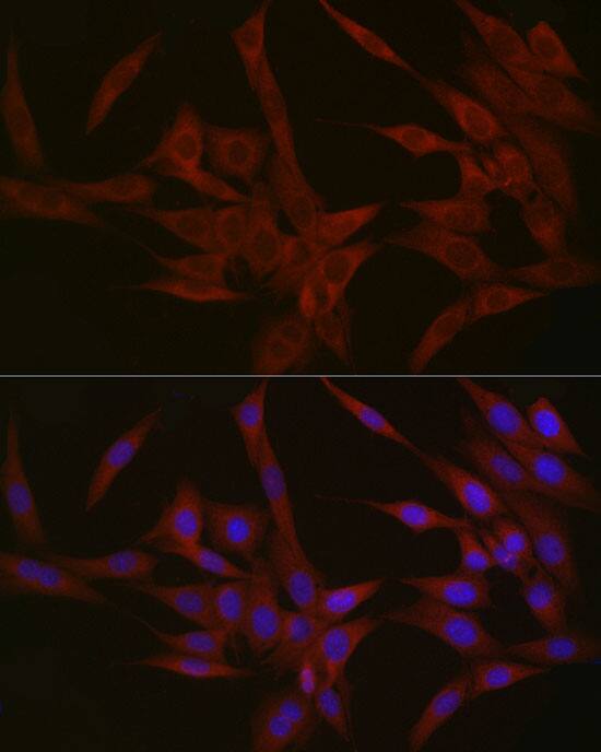 Nephronophthisis Antibody - Azide and BSA Free