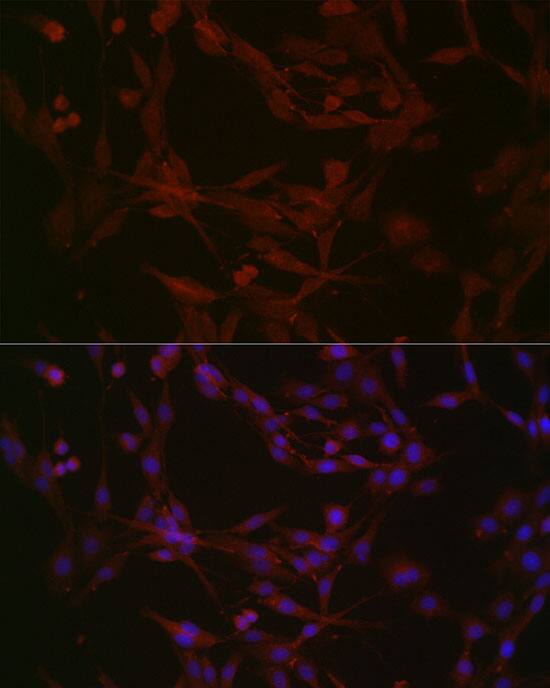 Nephronophthisis Antibody - Azide and BSA Free