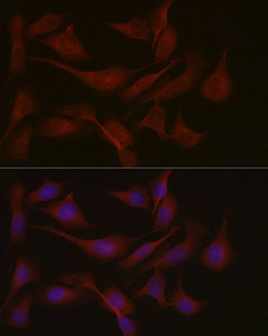 Nephronophthisis Antibody - Azide and BSA Free