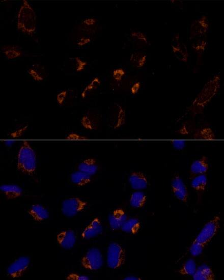 MTCH2 Antibody - Azide and BSA Free