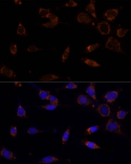 MTCH2 Antibody - Azide and BSA Free
