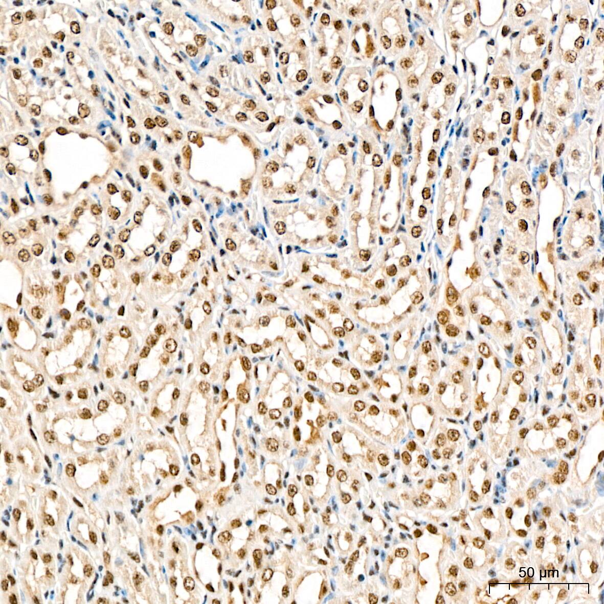 TRMT61A Antibody - Azide and BSA Free