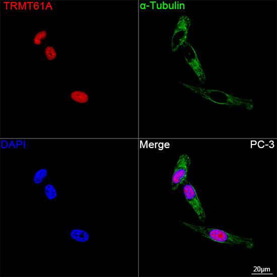 TRMT61A Antibody - Azide and BSA Free