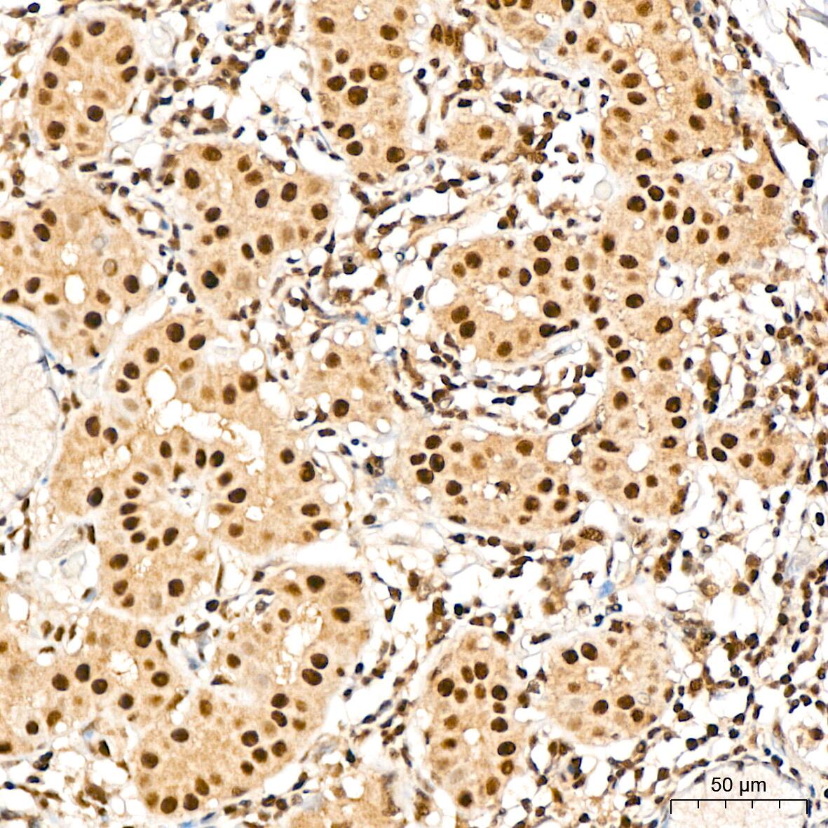 TRMT61A Antibody - Azide and BSA Free