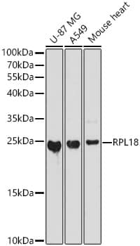 RPL18 Antibody - Azide and BSA Free