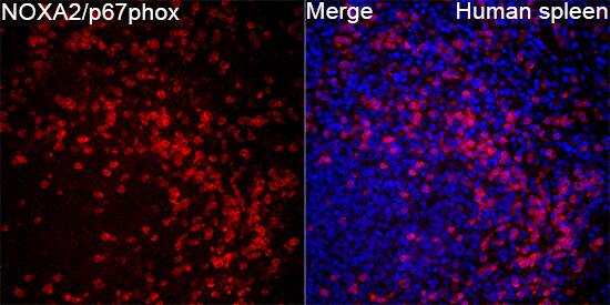 p67phox/NOXA2 Antibody - BSA Free