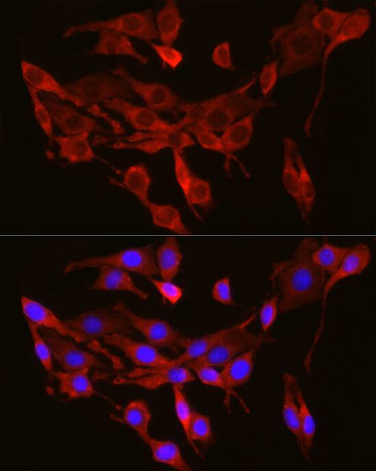 SEC61A Antibody - Azide and BSA Free