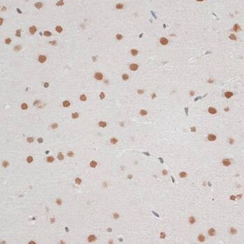 ZNF148 Antibody - BSA Free