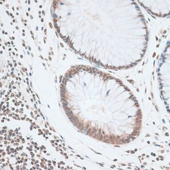 ZNF148 Antibody - BSA Free