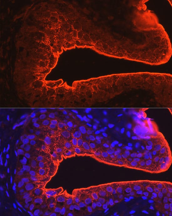 Uroplakin III Antibody - BSA Free