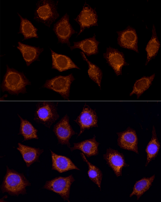 SUCLA2 Antibody - BSA Free