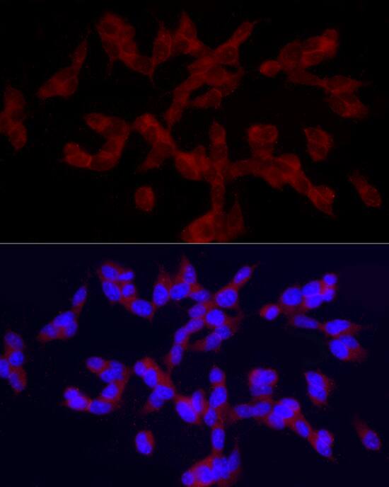TRPC5 Antibody - Azide and BSA Free