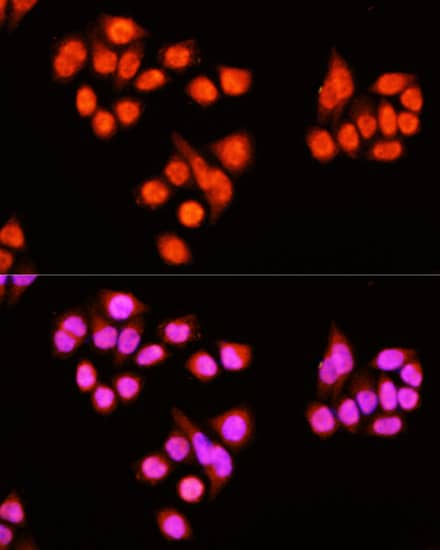 ZNF408 Antibody - BSA Free