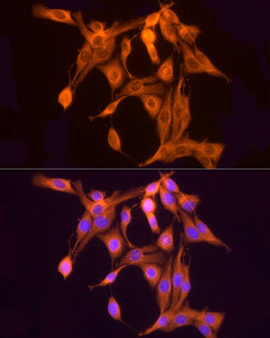 ULBP-2 Antibody - Azide and BSA Free