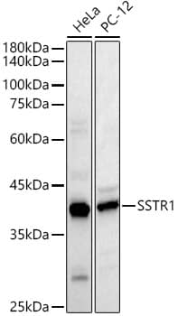 Somatostatin R1/SSTR1 Antibody - Azide and BSA Free