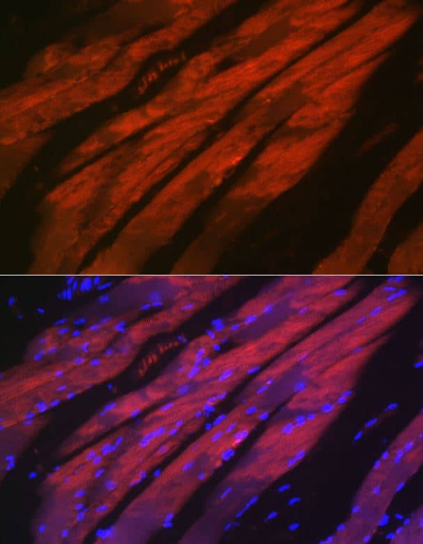 Myosin heavy chain 2 Antibody