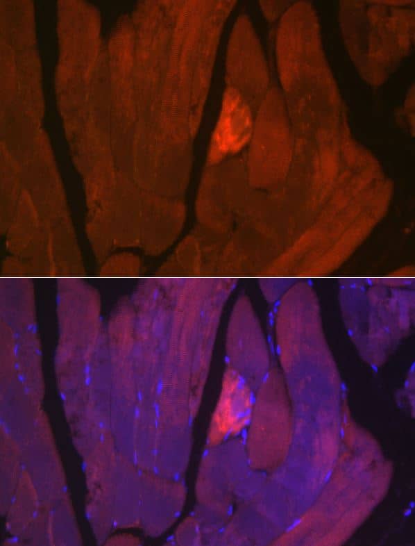 Myosin heavy chain 2 Antibody