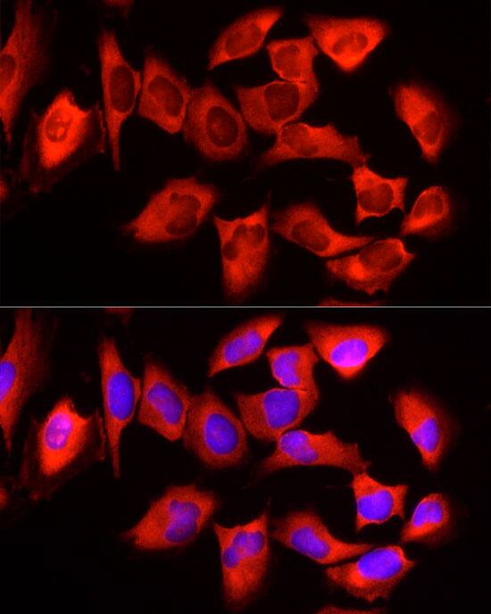 YTHDF3 Antibody - BSA Free