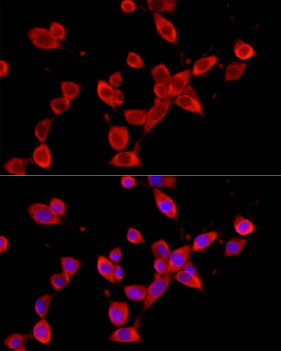 YTHDF3 Antibody - BSA Free