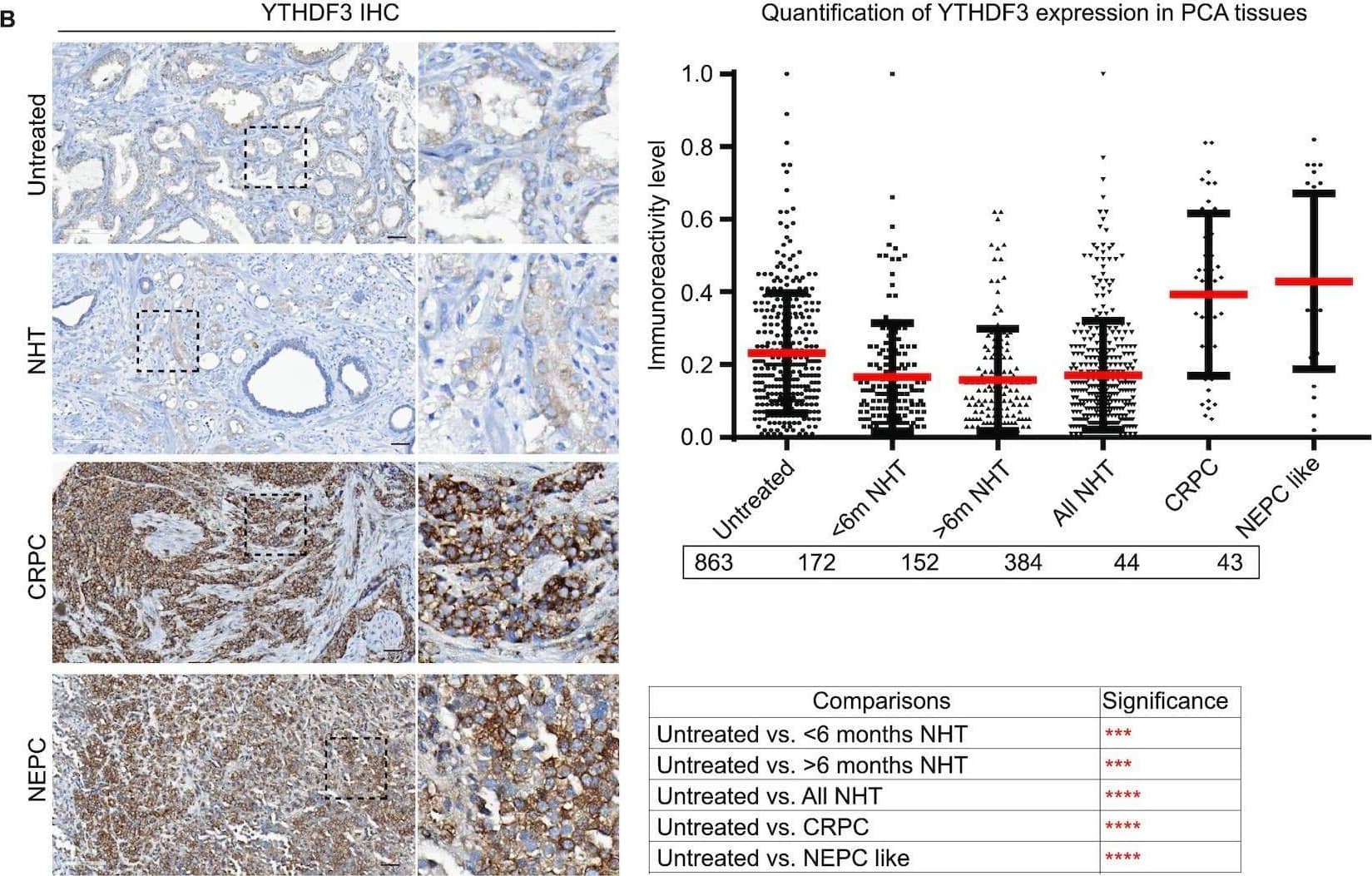 YTHDF3 Antibody - BSA Free