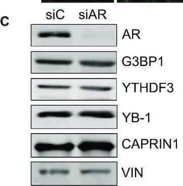 YTHDF3 Antibody - BSA Free