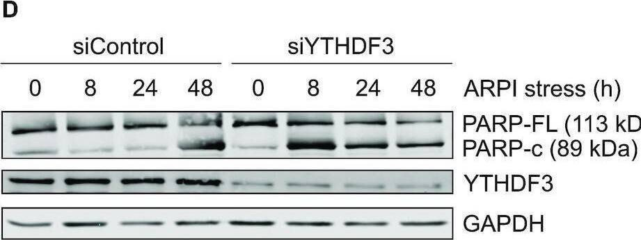 YTHDF3 Antibody - BSA Free