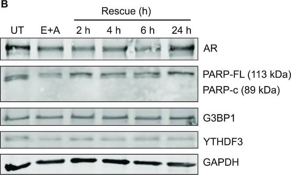 YTHDF3 Antibody - BSA Free