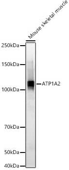 Sodium Potassium ATPase Alpha 2 Antibody