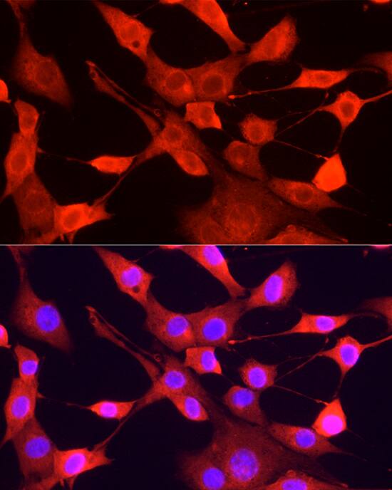 ULK1 Antibody - Azide and BSA Free