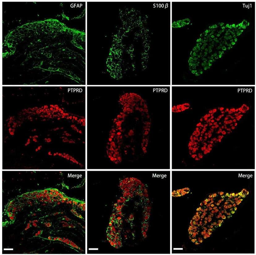 PTPRD Antibody