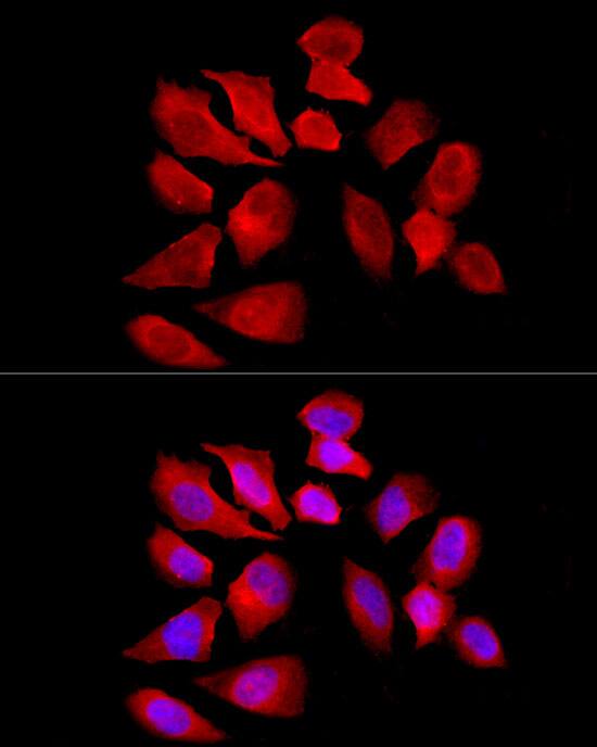 OCTN2/SLC22A5 Antibody - BSA Free
