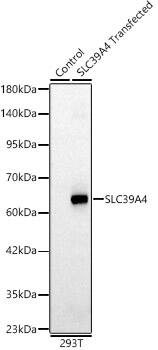 SLC39A4/ZIP4 Antibody - BSA Free