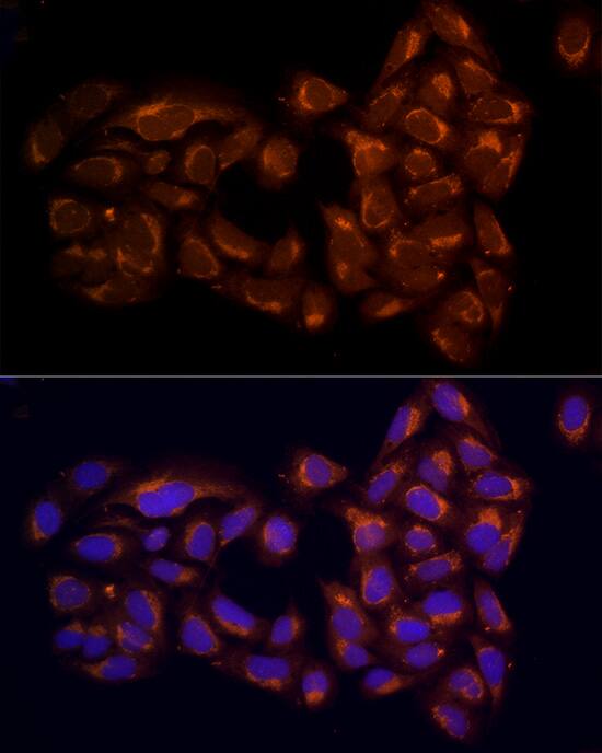 RPH3AL Antibody - BSA Free