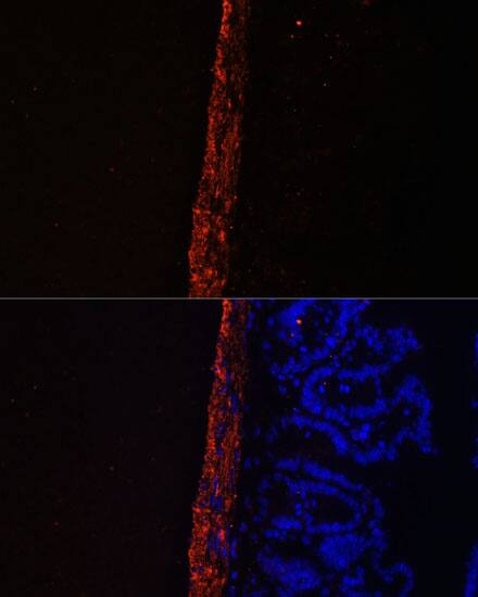 MYL9 Antibody - Azide and BSA Free