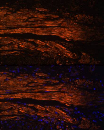 MYL9 Antibody - Azide and BSA Free