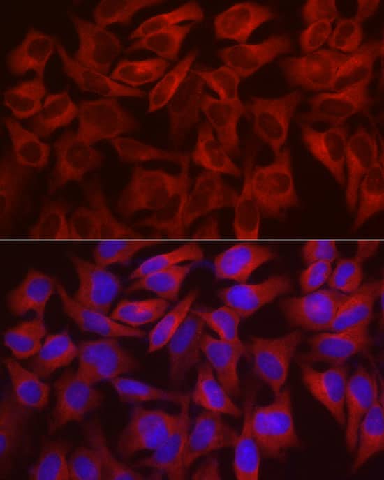 WISP2 Antibody - Azide and BSA Free