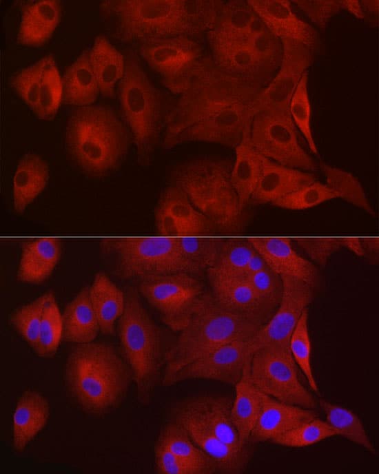 WISP2 Antibody - Azide and BSA Free