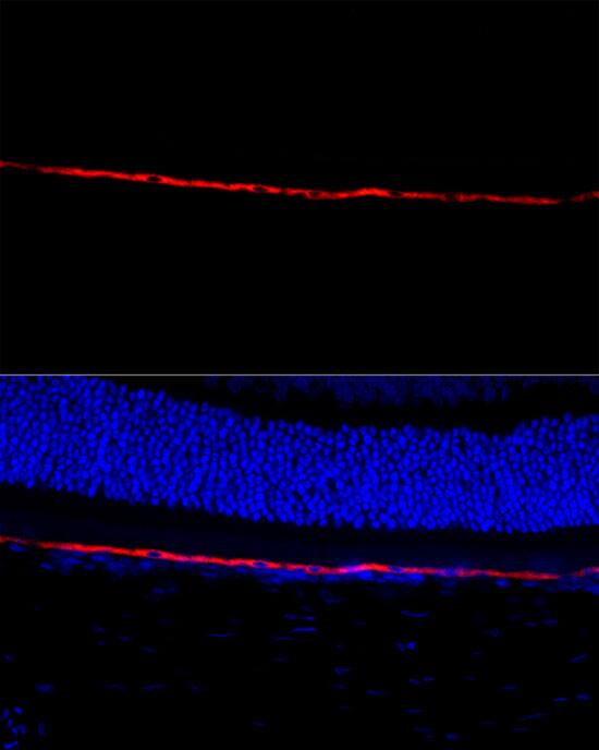 RPE65 Antibody - BSA Free