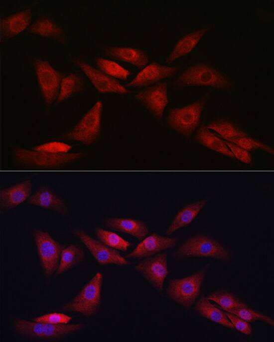 Notch-1 Antibody - Azide and BSA Free