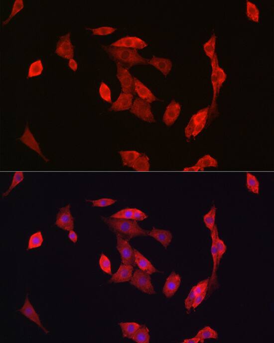 Notch-1 Antibody - Azide and BSA Free
