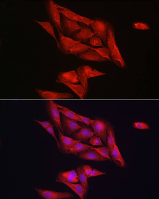 Notch-1 Antibody - Azide and BSA Free