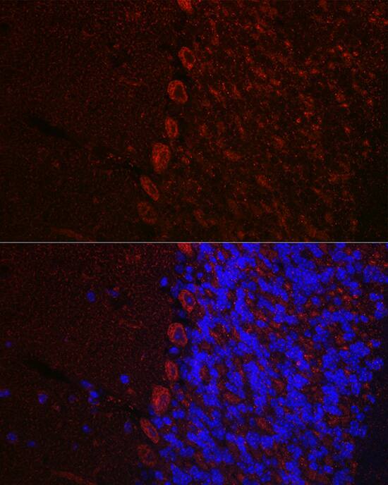 Orexin R1/HCRTR1 Antibody - Azide and BSA Free