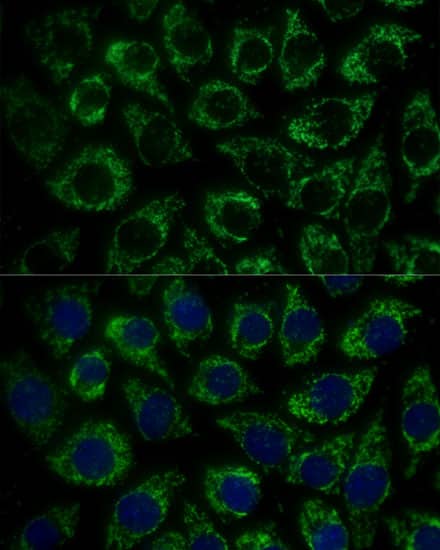 MTIF2 Antibody - Azide and BSA Free