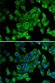 Periplakin Antibody - BSA Free