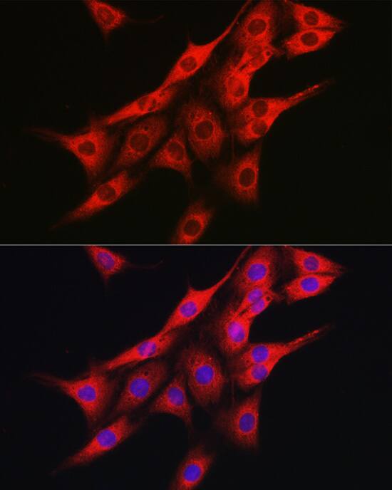 IRE1 alpha Antibody - Azide and BSA Free