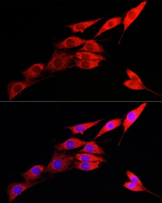 IRE1 alpha Antibody - Azide and BSA Free