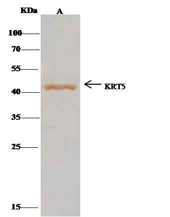Cytokeratin 5 Antibody Immunoprecipitation: Cytokeratin 5 Antibody [NBP2-95276]