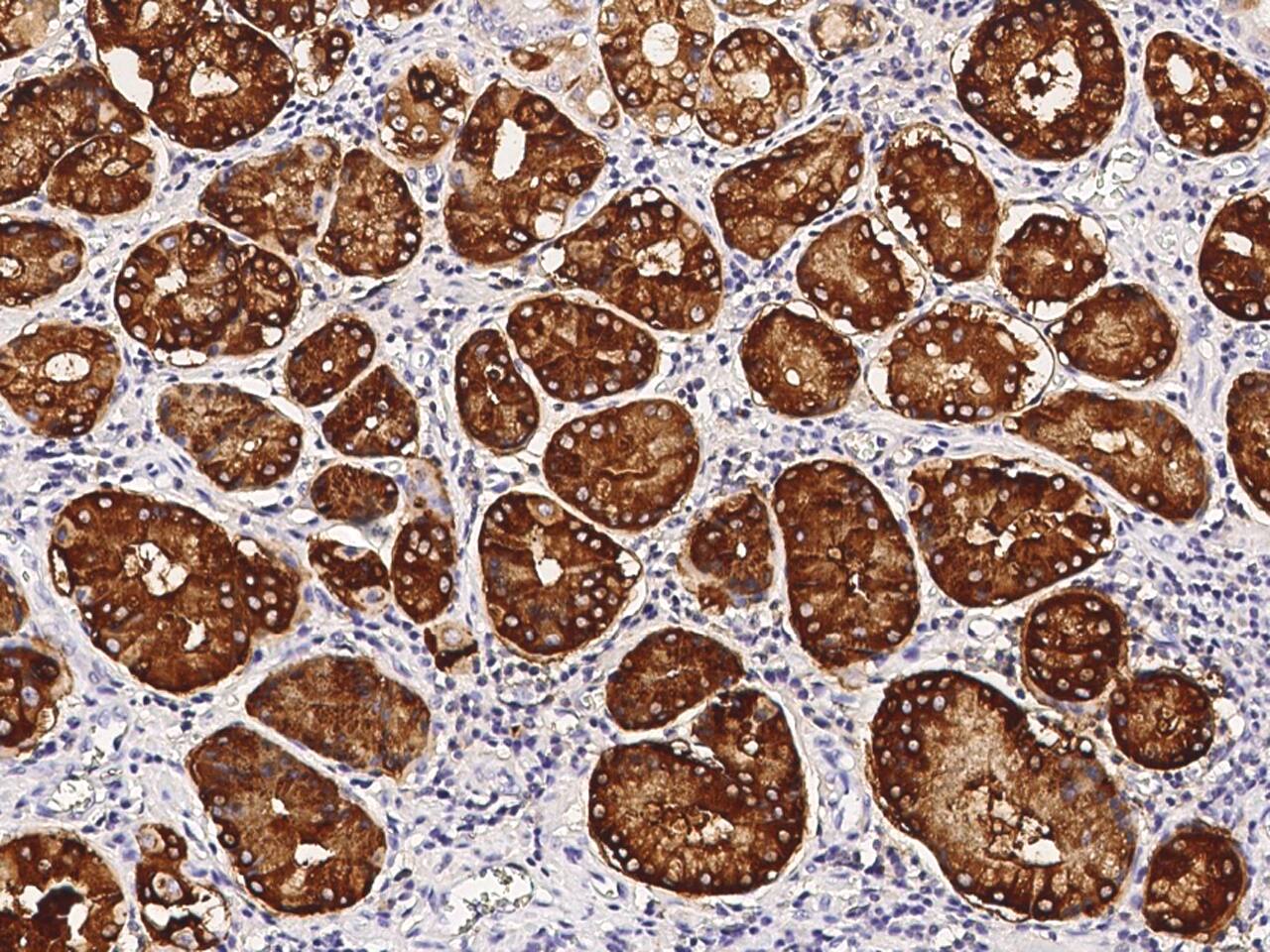 Gastric Lipase Antibody - Azide and BSA Free